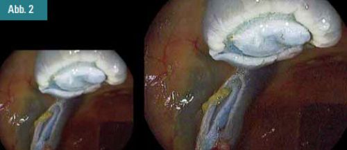 Abbildung 2
