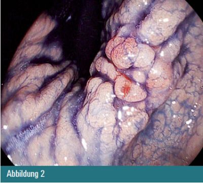 Abbildung 2