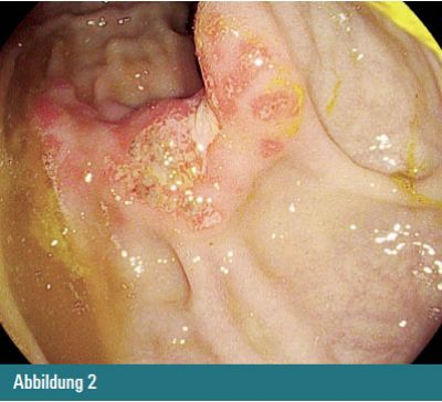 Abbildung 2